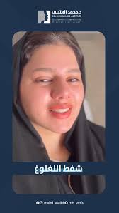 حالة شفط لغلوغ قبل وبعد , ( اشكر المريضه لسماحها بعرض الحالة ), #شفط_لغلوغ  #دبل_شين #الذقن_المزدوج #الذقن_المزدوجة Double_chin#