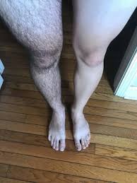 So, eventually whatever this would cost you should be all worth it. Men Removing Leg And Arm Hair Girlsaskguys