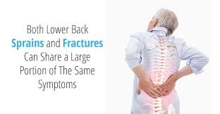 Suffering from a pulled upper back muscle can be an agonizing experience. How To Tell The Difference Between A Lower Back Sprain And A Fracture In The Lower Back Nose Creek Physiotherapy Calgary