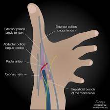 We did not find results for: Anatomical Snuff Box Illustration Radiology Case Radiopaedia Org