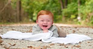 5 physical characteristics of children born with down syndrome looking at your precious new addition you may or may not notice anything out of the ordinary about their appearance. The Why Of Down Syndrome Adoption Lifesong For Orphans