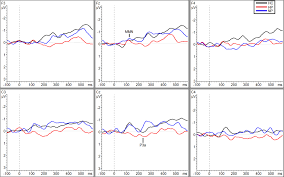 Jeremy jordan, ashley spencer & seth rudetsky 1/31 8 pm et. Frontiers Interaction Of Background Noise And Auditory Hallucinations On Phonemic Mismatch Negativity Mmn And P3a Processing In Schizophrenia Psychiatry