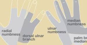So can blood flow issues or a range of other medical conditions. Numbness In Hands Causes Treatment The Hand Society
