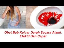 Bab keluar darah membatalkan puasa. Berak Berdarah Penyebab