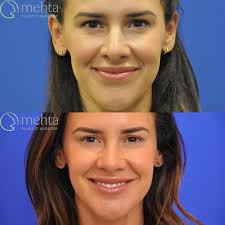 Mehta Plastic Surgery added a new...