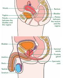 Blood in urine (hematuria), which may cause urine to appear bright red or cola colored, though sometimes the urine appears normal and blood is detected on a lab test Bladder Cancer Harrogate And District Nhs Foundation Trust