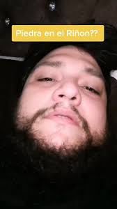 Cuidense amigos: Información sobre piedras en el riñon
