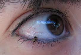 They can be regionally specific, seasonal, or even make their way through a specific cat population. Oriental Eye Worm Infection Which Can Blind Your Pets Could Spread To The Uk After Break Outs Across Much Of Continental Europe