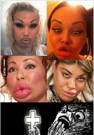 Omg Get Away Plastic Surgery Hysterically Funny Plastic Surgery Fail