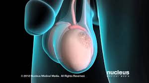 Testicular Cancer Youtube