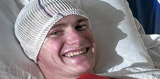 UAHS grad recovering from brain surgery after fall