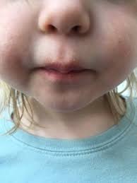We did not find results for: Chapped Lips Toddler Times Babycenter Canada