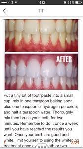 How To White Teeth At Home Diy Beauty Beauty Hacks Health And Beauty Tips