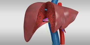 Liver transplant coping with a diagnosis according to the va , although cirrhosis is progressive, some people with the condition can move from decompensated, or symptomatic, back to the. Liver Transplant Living Donor Right Hepatectomy Donor Procedure Tvasurg The Toronto Video Atlas Of Surgery