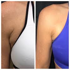 From the most popular looks and brands, to the deepest cleansers and latest treatments, we bring it all to you! Anna Stephens Aesthetics In Ruston La Styles Vagaro