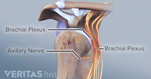 Various attempts of treatment (ultrasound, electric muscle stimulation, acupuncture, flexibility and strength, exercise) had failed to deliver complete relief. Brachial Neuritis Symptoms