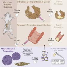 Stage iv cancers don't have a good prognosis as their relative survival rate for 5 years is about 11%. Mouse Model Of Colorectal Cancer Orthotopic Co Implantation Of Tumor And Stroma Cells In Cecum And Rectum Sciencedirect