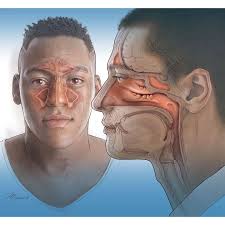 Job Showcase :: Medical Illustration and Animation