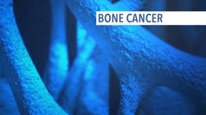 Enter your last name to learn its meaning and origin. Overview Of Bone Cancer Cancerconnect
