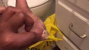 Read about possible causes of peeling skin and what you can do about it. Cast Off Dead Skin Flaking Dead Skin Youtube