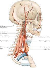 A piece of a plaque may break off and flow to smaller arteries in your brain. Arteries Of The Head And Neck Sciencedirect