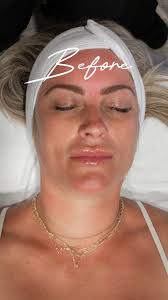 Oh Yes!!! We Are So Ready for Fall! , Glowing skin is always in, and  there’s no better way to achieve it than with our OxyGeneo Facial