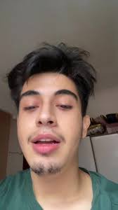 Sharon Woolridge Amputee