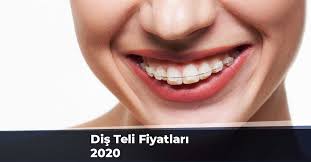 Dis Teli Fiyatlari 2020 Estetik Dis Hekimi Ankara Erce Belecoglu