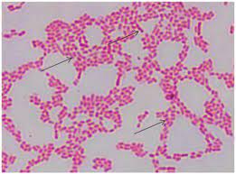 A number of its serovars are serious human pathogens. Macroscopic Observation Of S Enteritidis In Xld And Rsa Media A S Download Scientific Diagram