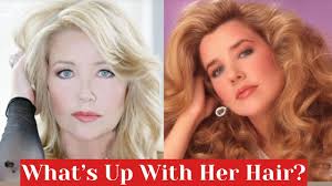 Why is Melody Thomas Scott wearing a wig