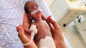 520 gram dogan nisa bebek 142 gun sonra ablalarina kavustu