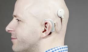 AAMI CI86 Cochlear Implant Systems