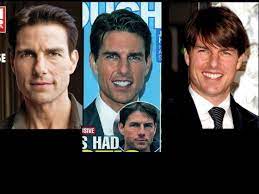 Find out which plastic surgery procedures are performed most often. Tom Cruise Plastic Surgery Did He Have It Cosmeticsurg