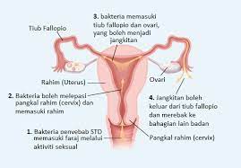 Ini akan memberi kesan kepada kesihatan anda secara keseluruhan, bukan hanya kepada kesihatan alat sulit. Dr Hamid Arshat Ajar Wanita Cara Lakukan Saline Douching Bagi Elak Jangkitan Kuman Dalam Peranakan Mingguan Wanita