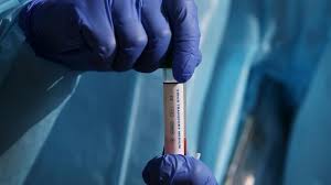 Cases are surging in parts of asia and south america. Coronavirus Australia Nsw Sydney Virus Cases More Than Triple More Than Detected Study Suggests