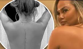 Chrissy Teigen Glows As She Debuts Delicate Back Tattoo Tribute To John Legend S Sexy Song Ooh Laa Daily Mail Online