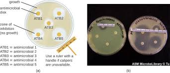 14 4 Testing The Effectiveness Of Antiseptics And Disinfectants Microbiology Canadian Edition