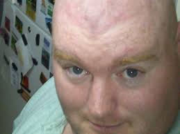 Dying to head south for euthanasia