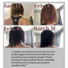 Moreover, the shampoo for hair loss is the one that contains castor oil. Formula D Hair Regrowth Serum Good For Ccca Etsy Hair Growth Oil Hair Regrowth Hair Growth Diy