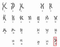 Week 4 genetics lesson 3 inheritance genes and chromosomes 12 1 inheritance of genes follows mendelian laws 12 2 alleles can produce multiple phenotypes 12 3. X Chromosome Wikipedia