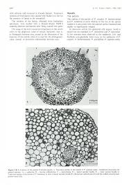 Image result for Pavetta lasiopeplus