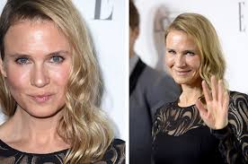 What's Really Behind The Ridicule Of Renée Zellweger's Face