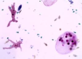 When the mixed liquor suspended solids and sludge age reach an optimum level for treatment, flagellates General Biology Microscopic Specimen Images Photographs