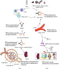 Image result for Vasculitis