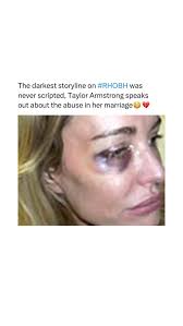 Are you surprised that Denise and Aaron are getting a divorce?👀  #erikajayne #deniserichards #kylerichards