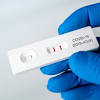 This is the most common type of hiv screening test. 1