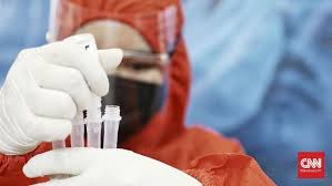 Satu pasien lainnya merupakan seorang prt yang bekerja untuk si pasien wanita berusia 28 tahun. 10 Kasus Varian Corona Asal India 3 Dki 4 Sumsel 3 Kalteng