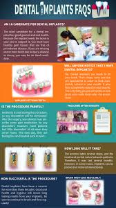 Pin By Irma Olguin On Dental Care Hacks Dental Implants Dental Dental Care