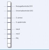 Ein beitrag des swr aus dem jahr 2010. Genotype Mrsa Schnelle Identifizierung Von Mrsa Aus Kultur
