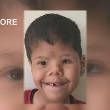 Boy from Gaza recovering after medical care in Shreveport